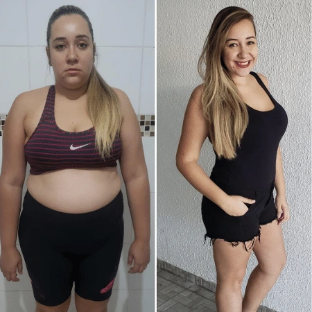 Antes e depois — Fernanda